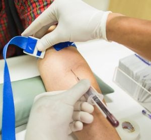 A chemical test for a DUI in Michigan can require either a blood draw or a breath sample